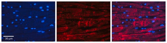 Anti-ADRB1 (C-terminal) antibody produced in rabbit affinity isolated antibody