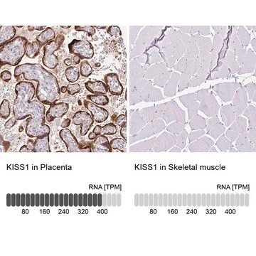 Anti-KISS1 antibody produced in rabbit Prestige Antibodies&#174; Powered by Atlas Antibodies, affinity isolated antibody, buffered aqueous glycerol solution