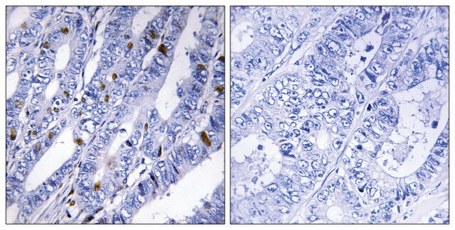 Anti-PKA-R2 &#946; antibody produced in rabbit affinity isolated antibody