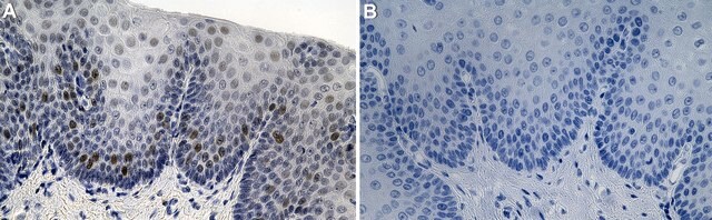 Anti-Cdc25A Antibody, clone 1M11 ZooMAb&#174; Rabbit Monoclonal recombinant, expressed in HEK 293 cells