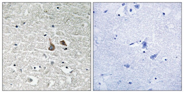 Anti-phospho-IRAK1 (pSer376) antibody produced in rabbit affinity isolated antibody