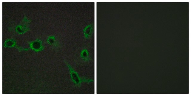 Anti-HTR7 antibody produced in rabbit affinity isolated antibody