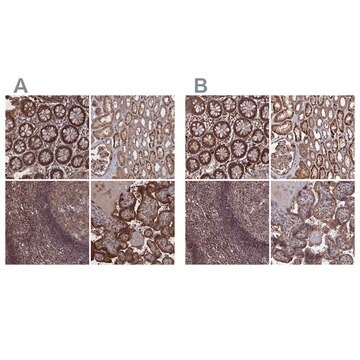 Anti-PLA2G15 antibody produced in rabbit Prestige Antibodies&#174; Powered by Atlas Antibodies, affinity isolated antibody, buffered aqueous glycerol solution