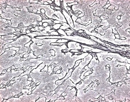 ISOSLIDE&#8482; Reticulin with reference tissue for the detection of reticular fibers in histology