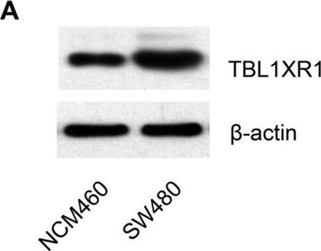 Anti-TBL1XR1 antibody produced in rabbit Prestige Antibodies&#174; Powered by Atlas Antibodies, affinity isolated antibody, buffered aqueous glycerol solution