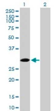 Anti-SPSB2 antibody produced in mouse purified immunoglobulin, buffered aqueous solution