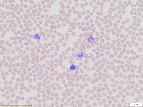 Wright-Giemsa Stain, Modified