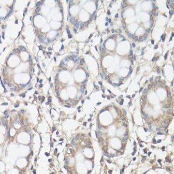 Anti-FAK antibody produced in rabbit