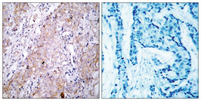 Anti-EGFR antibody produced in rabbit affinity isolated antibody