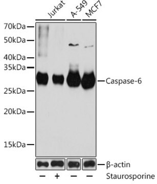 Anti-Caspase-6 Antibody, clone 6D7S2, Rabbit Monoclonal