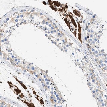 Anti-ULK4 antibody produced in rabbit Prestige Antibodies&#174; Powered by Atlas Antibodies, affinity isolated antibody, buffered aqueous glycerol solution