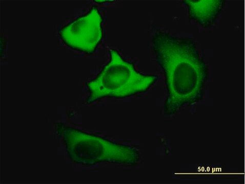 Anti-FASN antibody produced in mouse purified immunoglobulin, buffered aqueous solution