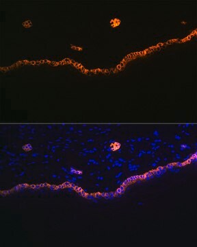 Anti-Cytokeratin 15 (KRT15) Antibody, clone 9F9F0, Rabbit Monoclonal