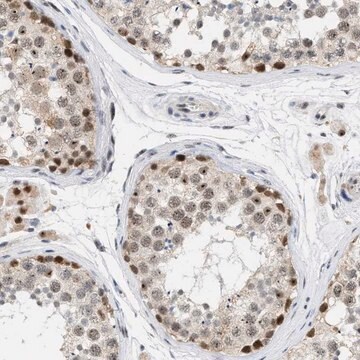 Anti-ELAC2 antibody produced in rabbit Prestige Antibodies&#174; Powered by Atlas Antibodies, affinity isolated antibody, buffered aqueous glycerol solution