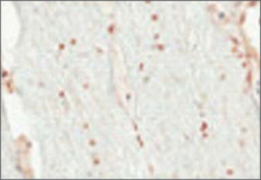 Anti-OLIG2 (AB2) antibody produced in rabbit affinity isolated antibody