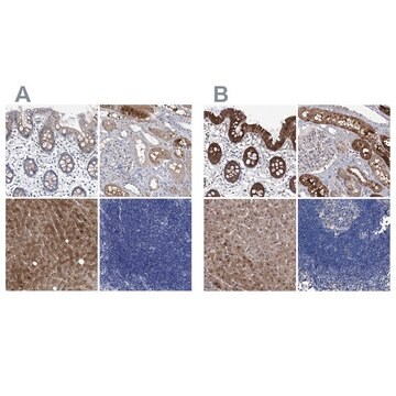 Anti-GPT antibody produced in rabbit Prestige Antibodies&#174; Powered by Atlas Antibodies, affinity isolated antibody, buffered aqueous glycerol solution, ab2