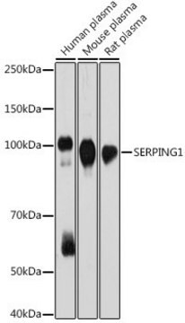 Anti-SERPING1 antibody produced in rabbit