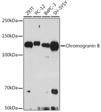 Anti-Chromogranin B Antibody, clone 5N6T1, Rabbit Monoclonal