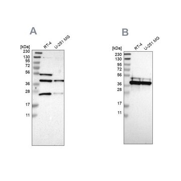 Anti-CCDC51 antibody produced in rabbit Prestige Antibodies&#174; Powered by Atlas Antibodies, affinity isolated antibody, buffered aqueous glycerol solution