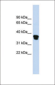 Anti-FAS antibody produced in rabbit affinity isolated antibody