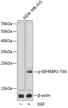 Anti-Phospho-EIF4EBP1-T36 antibody produced in rabbit