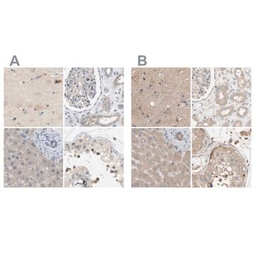 Anti-DCAF7 antibody produced in rabbit Prestige Antibodies&#174; Powered by Atlas Antibodies, affinity isolated antibody, buffered aqueous glycerol solution, Ab2