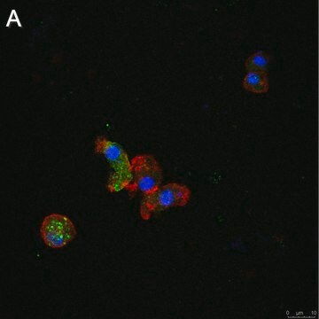 Anti-ATG8 Antibody, clone 2B11 ZooMAb&#174; Rabbit Monoclonal recombinant, expressed in HEK 293 cells