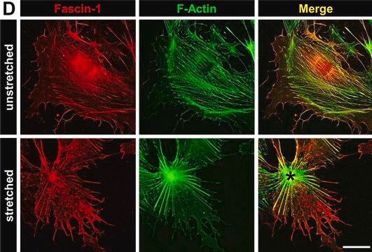 Anti-FSCN1 antibody produced in rabbit Prestige Antibodies&#174; Powered by Atlas Antibodies, affinity isolated antibody, buffered aqueous glycerol solution