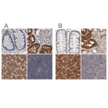 Anti-PNPO antibody produced in rabbit Prestige Antibodies&#174; Powered by Atlas Antibodies, affinity isolated antibody, buffered aqueous glycerol solution