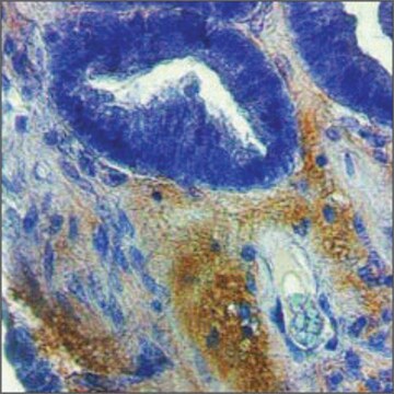 Anti-MMP2 IgG fraction of antiserum