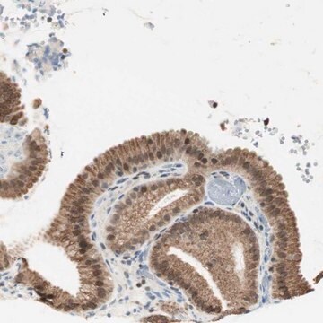 抗ZBTB17抗体 ウサギ宿主抗体 Prestige Antibodies&#174; Powered by Atlas Antibodies, affinity isolated antibody, buffered aqueous glycerol solution