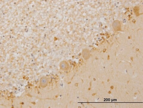 ANTI-LIMK1 antibody produced in mouse clone 2E9, purified immunoglobulin, buffered aqueous solution