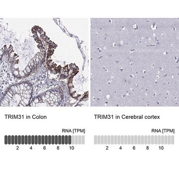 Anti-TRIM31 antibody produced in rabbit Prestige Antibodies&#174; Powered by Atlas Antibodies, affinity isolated antibody, buffered aqueous glycerol solution