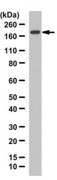 Anti-TIAM-1 from rabbit, purified by affinity chromatography