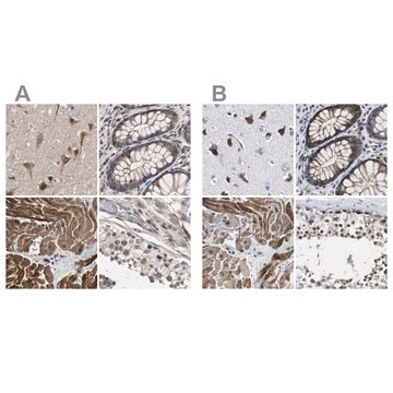 Anti-PITRM1 antibody produced in rabbit Ab1, Prestige Antibodies&#174; Powered by Atlas Antibodies, affinity isolated antibody, buffered aqueous glycerol solution