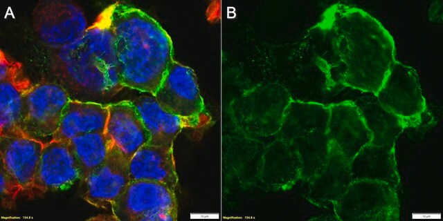 Anti-L1CAM/CD171 Antibody, clone S10.33