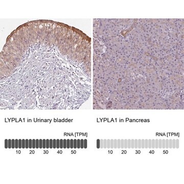 Anti-LYPLA1 antibody produced in rabbit Prestige Antibodies&#174; Powered by Atlas Antibodies, affinity isolated antibody, buffered aqueous glycerol solution