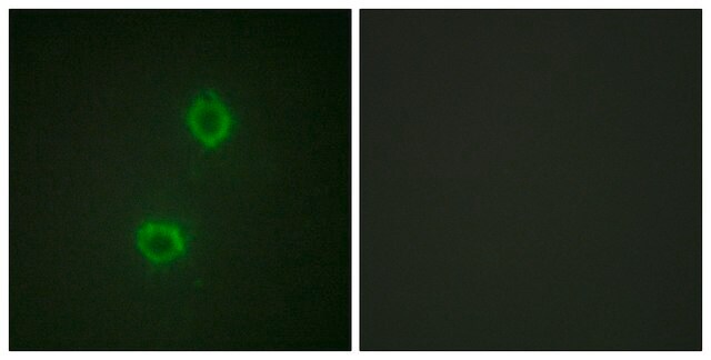 Anti-FGFR1 antibody produced in rabbit affinity isolated antibody