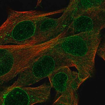 Anti-CYTL1 antibody produced in rabbit Prestige Antibodies&#174; Powered by Atlas Antibodies, affinity isolated antibody