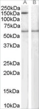 Anti-SPA1/SIPA1 antibody produced in goat affinity isolated antibody, buffered aqueous solution