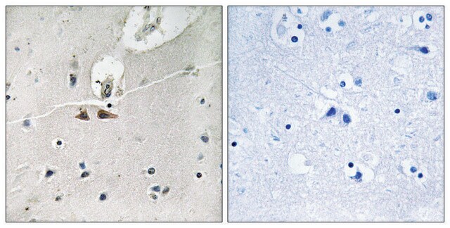 Anti-phospho-Ephrin B1/B2/B3 (pTyr324) antibody produced in rabbit affinity isolated antibody