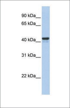 Anti-FOXJ1 antibody produced in rabbit affinity isolated antibody