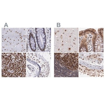 抗TERF2抗体 ウサギ宿主抗体 Ab1, Prestige Antibodies&#174; Powered by Atlas Antibodies, affinity isolated antibody, buffered aqueous glycerol solution