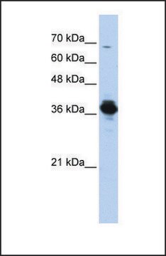 Anti-ATP6V0D2 antibody produced in rabbit affinity isolated antibody