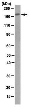 Anti-P-Rex1 Antibody, clone 6F12 clone 6F12, from mouse