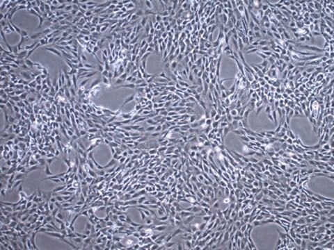 C20A4 Human Chondrocyte Cell Line C20A4 Human Chondrocyte Cell Line is widely used as a model cell line for studying normal and pathological cartilage repair mechanisms related to chondrocyte biology and physiology.