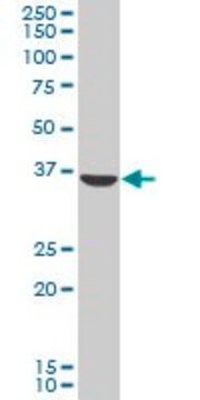 Anti-AKR1C2 antibody produced in mouse purified immunoglobulin, buffered aqueous solution