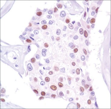 Anti-Progesterone Receptor antibody, Rabbit monoclonal recombinant, expressed in proprietary host, clone SP42, tissue culture supernatant