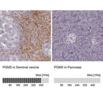 Anti-PGM5 Prestige Antibodies&#174; Powered by Atlas Antibodies, affinity isolated antibody