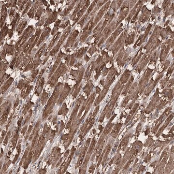 Anti-PIK3C2A antibody produced in rabbit Prestige Antibodies&#174; Powered by Atlas Antibodies, affinity isolated antibody, buffered aqueous glycerol solution